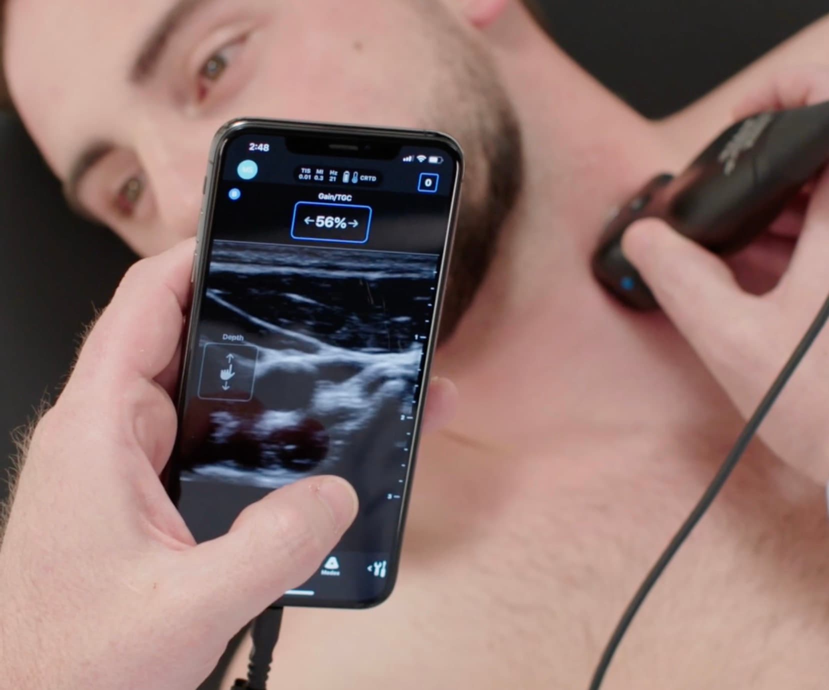 Portable ultrasound for EMS paramedics Butterfly iQ3